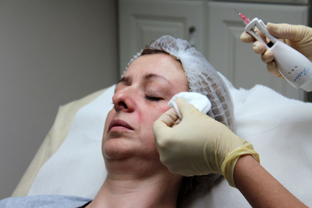 Инъекции красоты — RESTYLANE и JALUPRO. Личный опыт. Restylane Vital